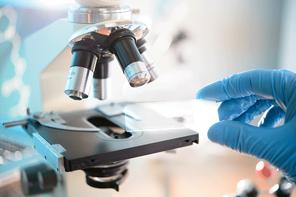 Detailed image of a hand wearing a blue surgical glove placing a glass plate onto the platform of a microscope. 